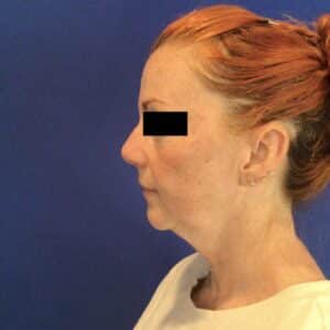 Before Image: Patient Case #6767