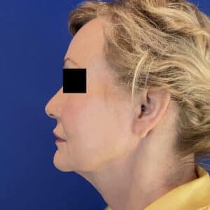 Before Image: Patient Case #6846