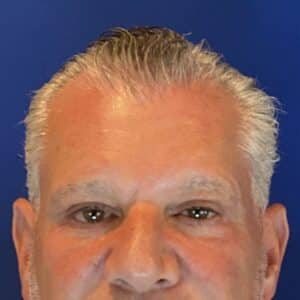 After Image: Patient Case #3531