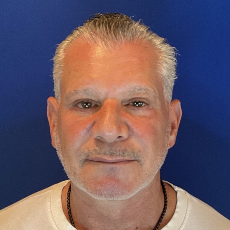 After Image: Patient Case #3641 - front