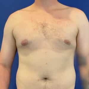 After Image: Patient Case #6754