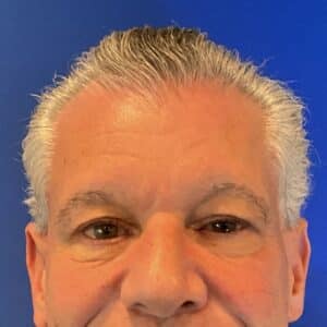 Before Image: Patient Case #3531