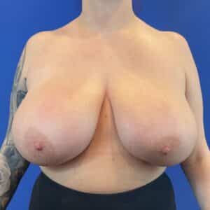 Before Image: Patient Case #6746