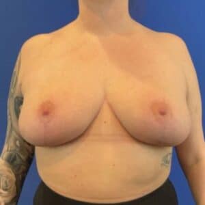 After Image: Patient Case #6746