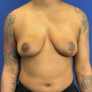 After Image: Patient Case #6899