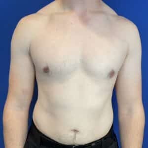 After Image: Patient Case #6936