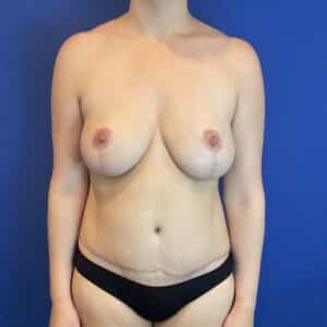 After Image: Patient Case #6970