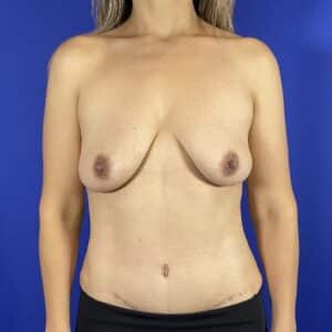 After Image: Patient Case #7006