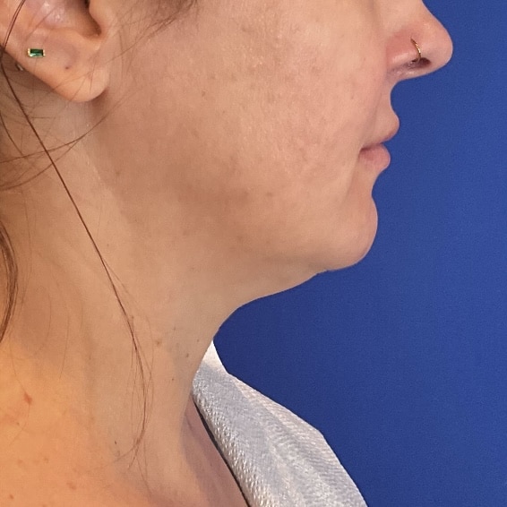 Before Image: Patient Case #7016 -