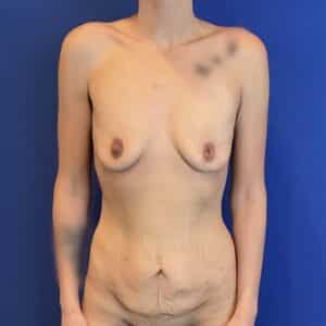 Before Image: Patient Case #7028