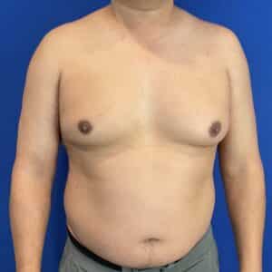 Before Image: Patient Case #7061