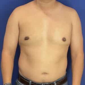 After Image: Patient Case #7061