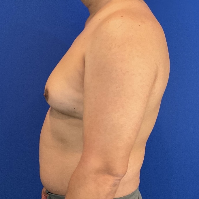 Before Image: Patient Case #7061 -