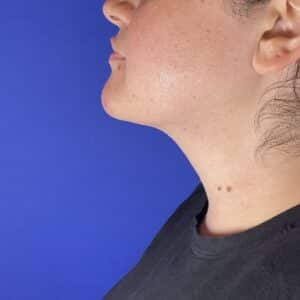 After Image: Patient Case #7130