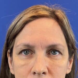 Before Image: Patient Case #6820