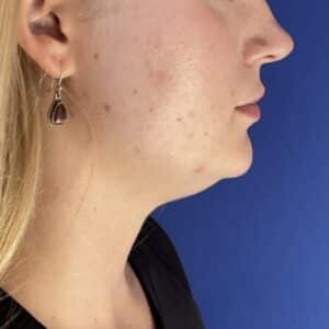 Before Image: Patient Case #7140