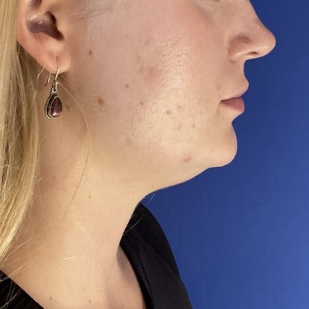 Before Image: Patient Case #7140 - right-side