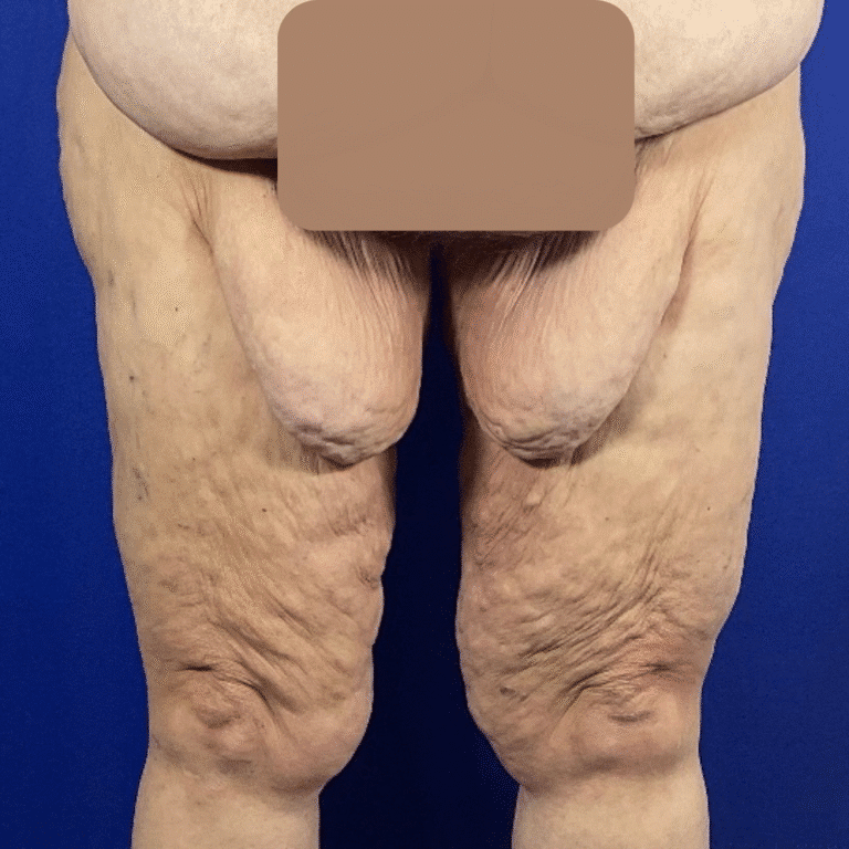 Before Image: Patient Case #7184 - front