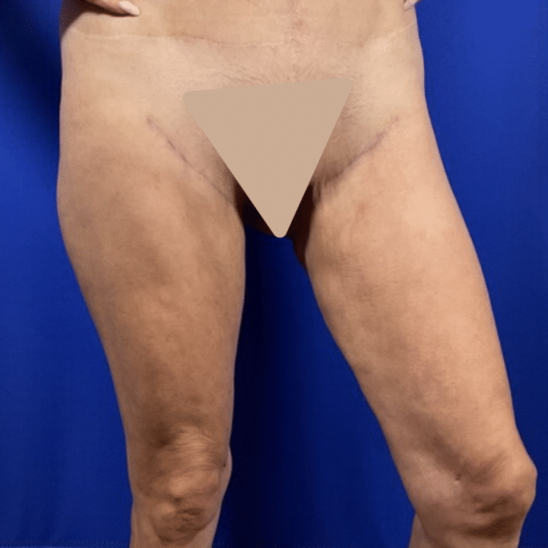 After Image: Patient Case #7193 - front