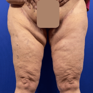 After Image: Patient Case #7184