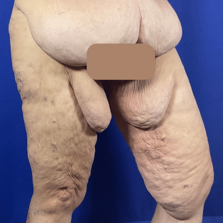 Before Image: Patient Case #7184 - right-front-oblique