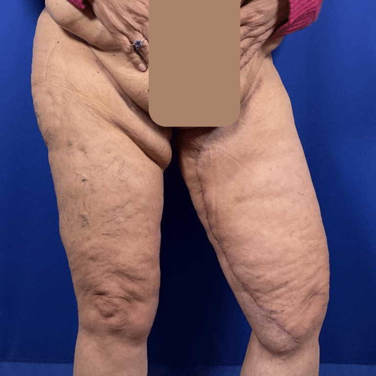 After Image: Patient Case #7184 - right-front-oblique