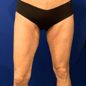 Before Image: Patient Case #7193