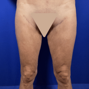 After Image: Patient Case #7193